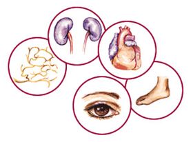 Órganos aos que complicacións da diabetes mellitus